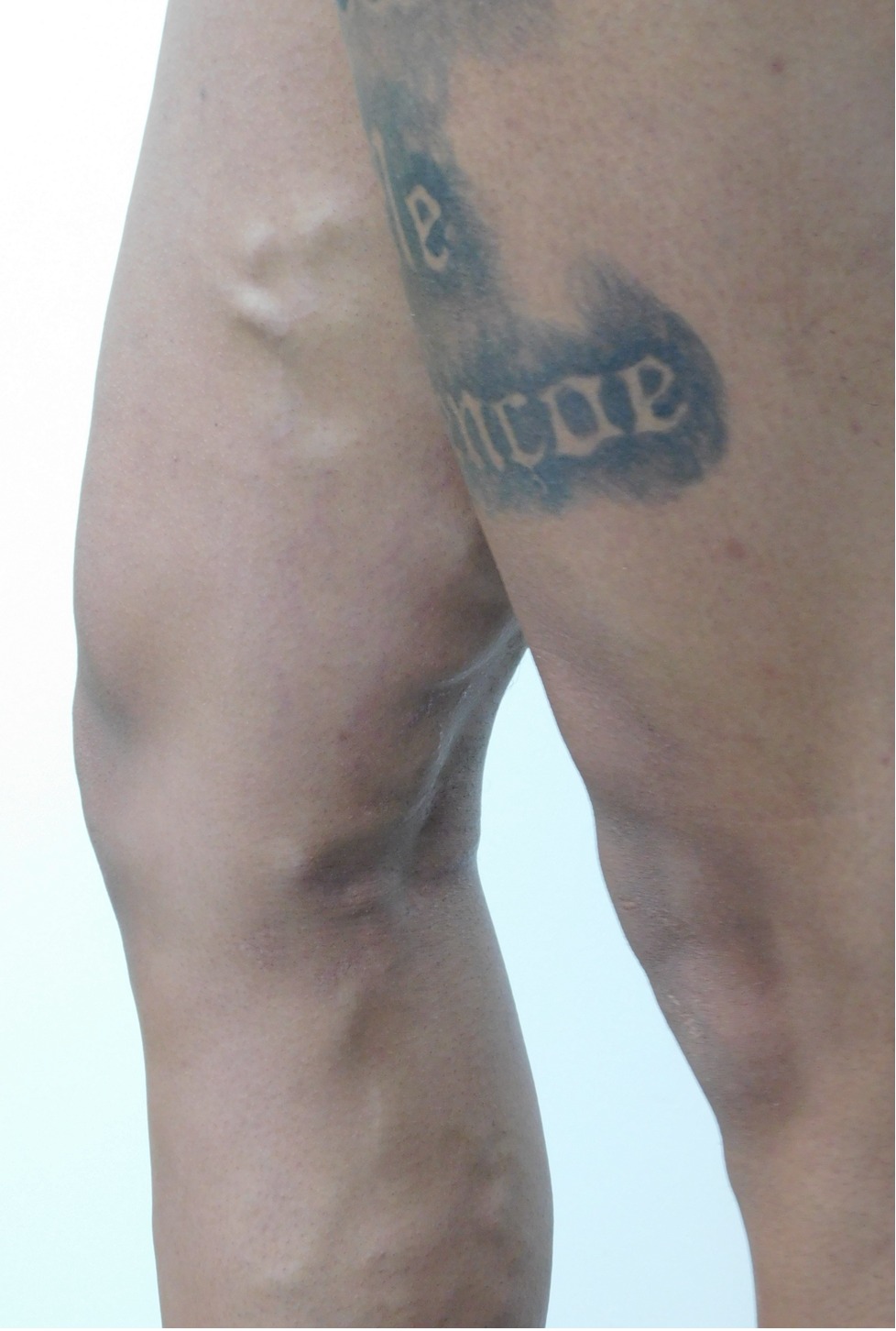 Antes